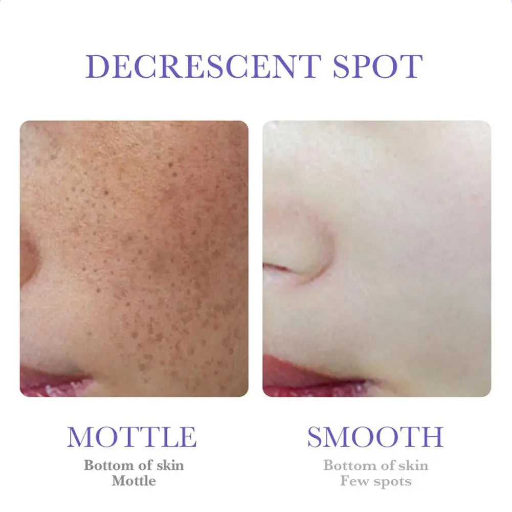 1/3pcs Nicotinamide Face Cream Lightening Skin Tone Face Skin Care Facial Cream Moisturizers Nourishing Smoothing